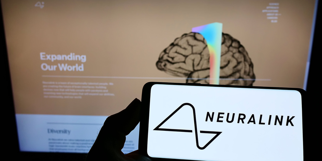 Elon Musk-Backed Brain Hacking Firm Neuralink Raises $280 Million